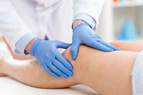 Когда нужно идти к флебологу