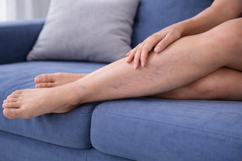 Судороги в икроножных мышцах ночью - сигнал проблем с венами